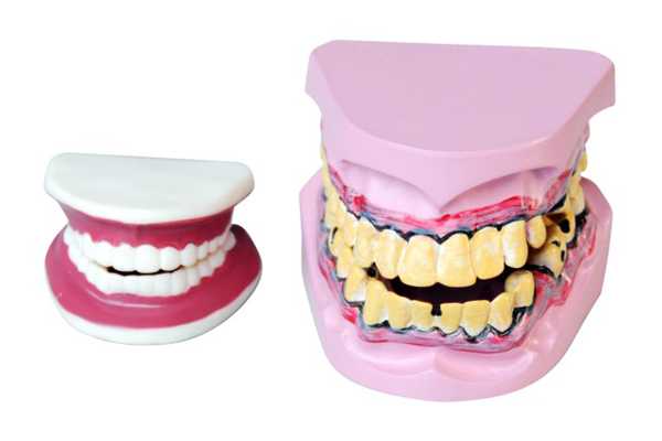 337-1 牙保健模型