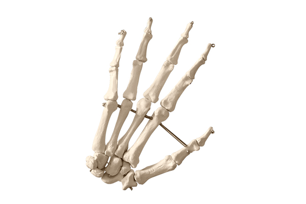 156 finger joint model